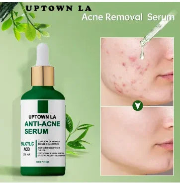 Uptown LA Anti-Acne Serum – Clear Skin with Salicylic Acid