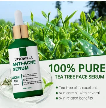 Uptown LA Anti-Acne Serum – Clear Skin with Salicylic Acid