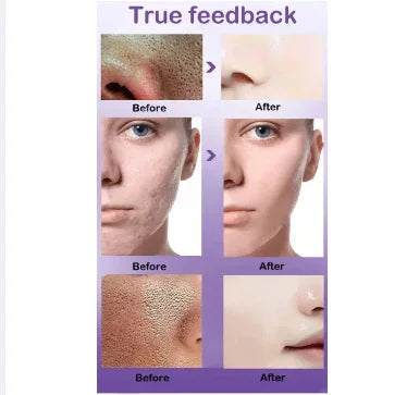 Uptown LA Pore Refining Serum – Smooth & Tighten Skin
