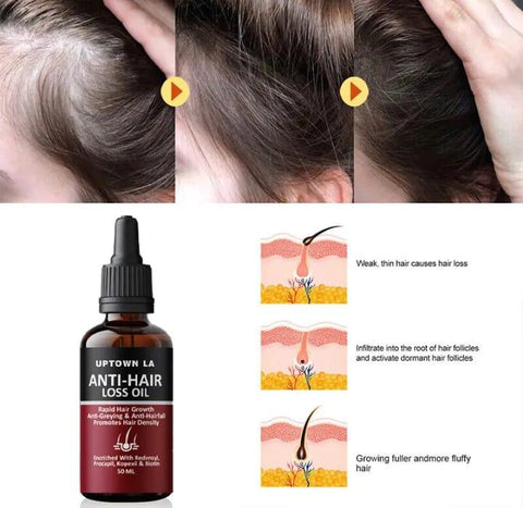 Uptown LA Anti-Hair Loss Oil – Rapid Hair Growth & Anti-Hairfall Solution | Twista Mall