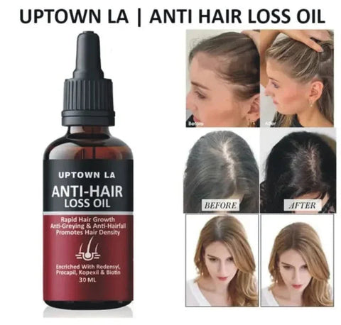 Uptown LA Anti-Hair Loss Oil – Rapid Hair Growth & Anti-Hairfall Solution | Twista Mall
